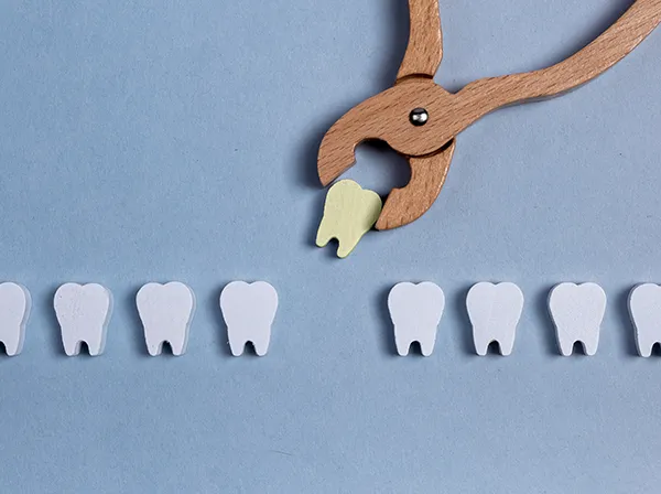 Row of wooden tooth shapes, one of which is being pulled out of the row by dental pliers, as if it's a real tooth extraction.